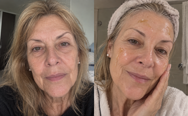 Antes y después — Carolina Zañartu