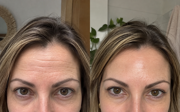 Antes y después — Josefa V