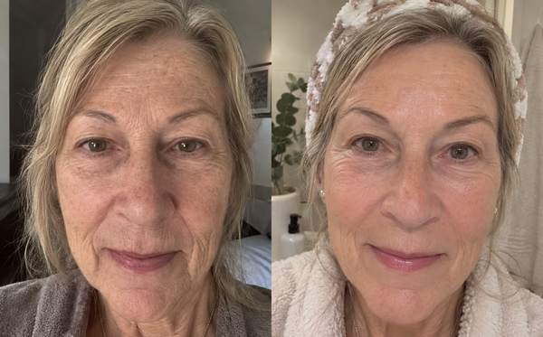 Antes y después — Lorena E.